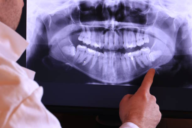 Best Emergency Wisdom Teeth Removal in Union, MO